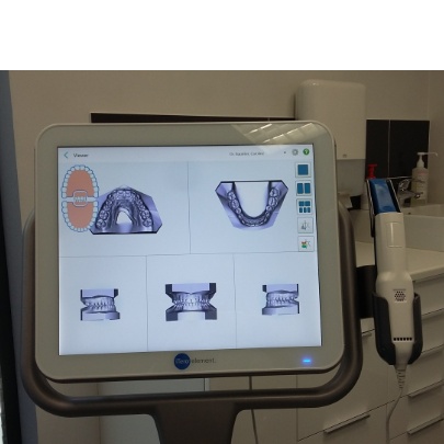 20170706 113347 20170706 113347